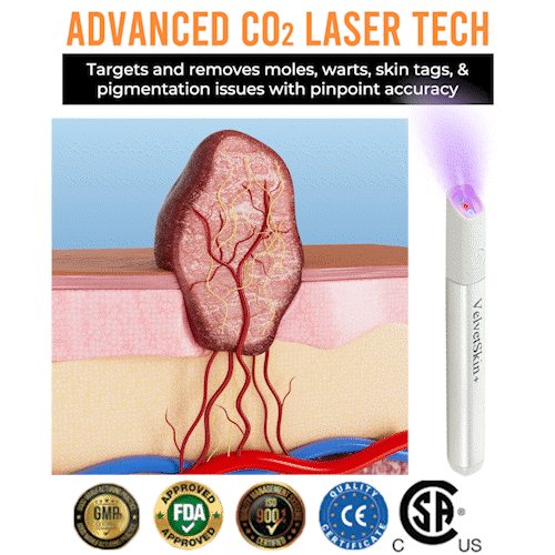 ✨EETTSY™ All-in-One CO₂ Laser Eraser Pen | Removes Moles, Warts, Skin Flaws & Pigmentation