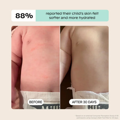 Baby Bath Tub Filter