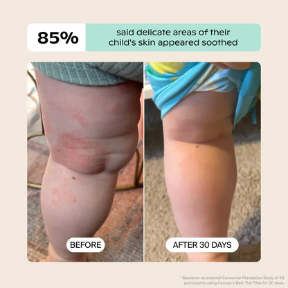 Baby Bath Tub Filter