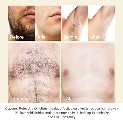 🔥Last Day 50% OFF - 💡Cyperus Rotundus Oil